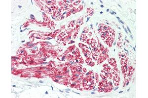 Anti-L1CAM antibody IHC staining of human peripheral nerve. (L1CAM antibody  (AA 1154-1182))