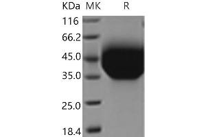 Western Blotting (WB) image for Hepatitis A Virus Cellular Receptor 2 (TIM 3) (AA 1-191) protein (His tag) (ABIN7320033)