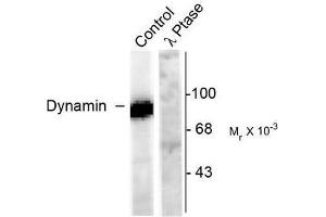 Image no. 1 for anti-Dynamin 1 (DNM1) (pSer778) antibody (ABIN372617) (Dynamin 1 antibody  (pSer778))