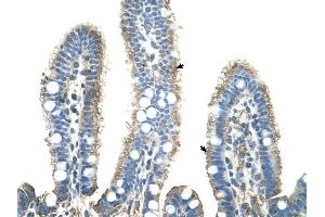 APCS antibody was used for immunohistochemistry at a concentration of 4-8 ug/ml to stain Epithelial cells of intestinal villus (arrows) in Human Intestine. (APCS antibody  (N-Term))