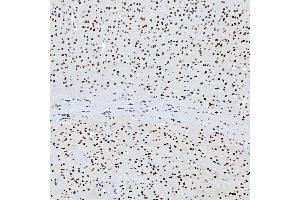 IHC analysis of SF3B3 using anti-SF3B3 antibody (ABIN7602378).