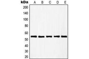 Western blot analysis of RAD23B expression in A431 (A), HuvEc (B), HEK293 (C), HeLa (D), HT29 (E) whole cell lysates. (RAD23B antibody  (N-Term))