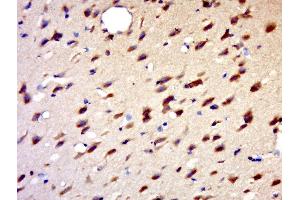 Paraformaldehyde-fixed, paraffin embedded rat brain, Antigen retrieval by boiling in sodium citrate buffer (pH6. (HENMT1 antibody  (AA 1-100))