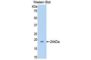 Western Blotting (WB) image for anti-Sirtuin 5 (SIRT5) (AA 48-244) antibody (ABIN1176396)