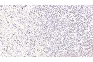 Detection of IGFBP1 in Human Spleen Tissue using Monoclonal Antibody to Insulin Like Growth Factor Binding Protein 1 (IGFBP1) (IGFBPI antibody  (AA 36-235))