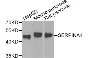 Western blot analysis of extracts of various cell lines, using SERPINA4 antibody (ABIN4905121) at 1:1000 dilution. (SERPINA4 antibody)