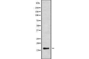Western blot analysis of CALML3 using K562 whole cell lysates (CALML3 antibody  (Internal Region))
