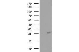 HEK293T cells were transfected with the pCMV6-ENTRY control (Left lane) or pCMV6-ENTRY CDKN3 (Right lane) cDNA for 48 hrs and lysed. (CDKN3 antibody)