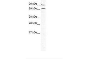 Image no. 1 for anti-Metastasis Associated 1 Family, Member 2 (MTA2) (AA 380-429) antibody (ABIN202862) (MTA2 antibody  (AA 380-429))