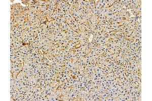 ABIN7095992 and ABIN7100054 at 1/100 staining mouse liver tissue by IHC-P. (SNAP47 antibody)
