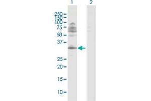 Western Blotting (WB) image for anti-Inhibitor of Growth Family, Member 4 (ING4) (AA 1-249) antibody (ABIN526498)