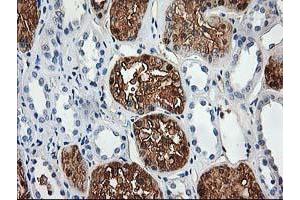 Immunohistochemical staining of paraffin-embedded Human Kidney tissue using anti-ACY1 mouse monoclonal antibody. (Aminoacylase 1 antibody)