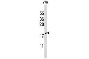 Western blot analysis of CIRBP Antibody (C-term) in Y79 cell line lysates (35µg/lane). (CIRBP antibody  (C-Term))