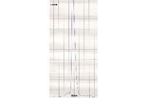 product purity: gel permeation chromatography (Superose 12/HR) (Mouse anti-Human IgE Antibody (Biotin))