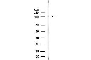 anti-Inositol Polyphosphate-4-Phosphatase, Type II, 105kDa (INPP4B) (C-Term) antibody