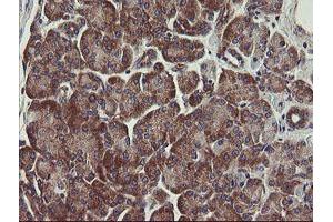 Image no. 8 for anti-Ubiquitin-Conjugating Enzyme E2, J1, U (UBE2J1) antibody (ABIN1501637)