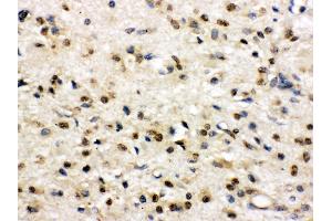 Immunohistochemistry (Paraffin-embedded Sections) (IHC (p)) image for anti-Discs, Large Homolog 4 (Drosophila) (DLG4) (AA 581-724) antibody (ABIN3043563) (DLG4 antibody  (AA 581-724))