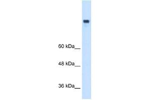 MTTP antibody used at 1 ug/ml to detect target protein. (MTTP antibody  (N-Term))