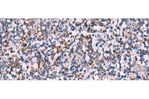 Immunohistochemistry of paraffin-embedded Human tonsil tissue using IPPK Polyclonal Antibody at dilution of 1:30(x200) (IPPK antibody)