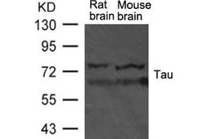 Western blot analysis of extract from rat brain and mouse brain tissue using TAU Antibody (MAPT antibody  (AA 725-729))