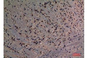 Immunohistochemistry (IHC) analysis of paraffin-embedded Mouse Brain, antibody was diluted at 1:100. (PREP antibody  (N-Term))