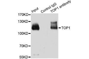 Immunoprecipitation analysis of 200ug extracts of HeLa cells using 3ug TOP1 antibody. (Topoisomerase I antibody)