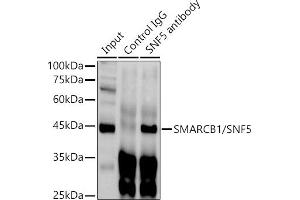 Immunoprecipitation analysis of 300 μg extracts of HeLa cells using 3 μg SM/SNF5 antibody . (SMARCB1 antibody  (AA 77-376))