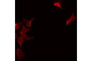 ABIN6277300 staining NIH-3T3 by IF/ICC. (NDUFS1 antibody  (N-Term))