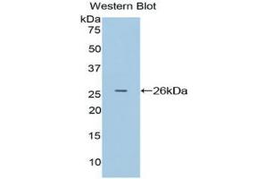 Western blot analysis of the recombinant protein. (APC antibody  (AA 2634-2842))