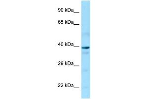 Western Blotting (WB) image for anti-Guanine Nucleotide Binding Protein (G Protein), alpha 14 (GNa14) (N-Term) antibody (ABIN2790107) (GNa14 antibody  (N-Term))
