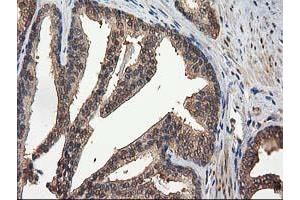 Image no. 12 for anti-Destrin (Actin Depolymerizing Factor) (DSTN) antibody (ABIN1497910) (Destrin antibody)