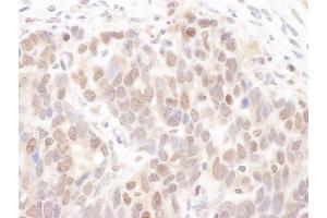 Immunohistochemistry (IHC) image for anti-Casein Kinase 2 alpha 1 (CSNK2A1) (C-Term) antibody (ABIN7453947)