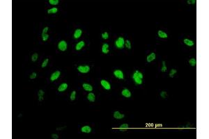 Immunofluorescence of monoclonal antibody to TLK2 on HeLa cell. (TLK2 antibody  (AA 1-126))