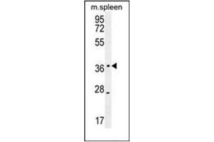 Western blot analysis of KLHDC1 Antibody (N-term) in mouse spleen tissue lysates (35ug/lane). (KLHDC1 antibody  (N-Term))