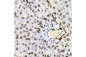 Immunohistochemistry of paraffin-embedded Rat liver using Dimethyl-Histone H3-K4 antibody (ABIN5969803) at dilution of 1/100 (40x lens). (Histone 3 antibody  (H3K4me2))