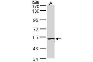 WB Image Sample (20 ug of whole cell lysate) A: Hep G2 , membrane extract 7. (ACVRL1 antibody  (C-Term))