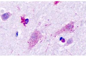 Anti-Histamine 3 Receptor / HRH3 antibody IHC staining of human brain, neurons. (HRH3 antibody  (Cytoplasmic Domain))