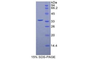 SDS-PAGE (SDS) image for Myosin Light Chain Kinase Family, Member 4 (MYLK4) (AA 96-353) protein (His tag,GST tag) (ABIN2126010)