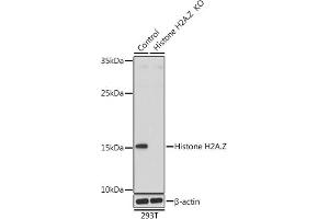 Western blot analysis of extracts from normal (control) and Histone H2A. (Histone H2A antibody  (AA 1-128))