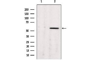Western blot analysis of extracts from rat brain, using ALDH7A1 antibody. (ALDH7A1 antibody  (C-Term))