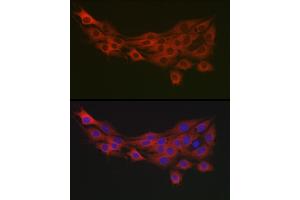 Immunofluorescence analysis of PC-12 cells using PDK1/PDHK1 Rabbit pAb (ABIN3015351, ABIN3015352, ABIN1681301, ABIN5663787 and ABIN6214001) at dilution of 1:100 (40x lens). (PDPK1 antibody  (AA 1-150))