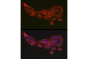 Immunofluorescence analysis of PC-12 cells using PDK1/PDHK1 Rabbit pAb (ABIN3015351, ABIN3015352, ABIN1681301, ABIN5663787 and ABIN6214001) at dilution of 1:100 (40x lens). (PDPK1 antibody  (AA 1-150))