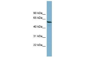 WB Suggested Anti-PGM3 Antibody Titration: 0. (Phosphoglucomutase 3 antibody  (Middle Region))