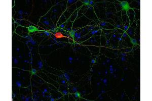 Indirect immunostaining of methanol fixed rat hippocampus neurons with anti-calretinin (dilution 1 : 500; red) and mouse anti-MAP 2 (cat.