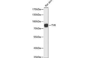 Western blot analysis of extracts of rat skin, using TYR antibody (ABIN6132743, ABIN6149746, ABIN6149747 and ABIN6217672) at 1:3000 dilution. (TYR antibody  (AA 20-340))