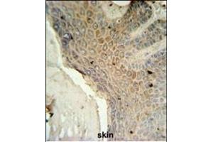 MFSD3 Antibody (Center) (ABIN651438 and ABIN2840241) IHC analysis in formalin fixed and paraffin embedded human skin tissue followed by peroxidase conjugation of the secondary antibody and DAB staining. (MFSD3 antibody  (AA 174-202))