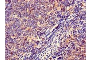 Immunohistochemistry of paraffin-embedded human lymph node tissue using ABIN7155597 at dilution of 1:100 (HLA-DQB1 antibody  (AA 128-175))