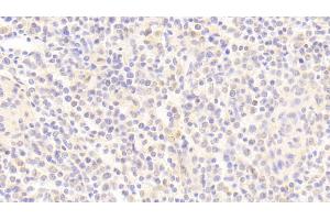 Detection of APBB1IP in Human Spleen Tissue using Polyclonal Antibody to Amyloid Beta Precursor Protein Binding B1 Interacting Protein (APBB1IP)