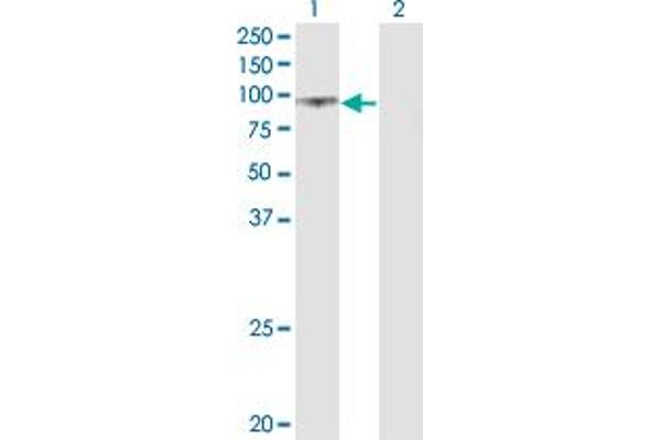 Uromodulin antibody  (AA 25-120)
