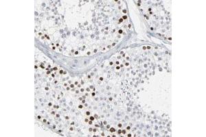 Immunohistochemical staining of human testis with SAGE1 polyclonal antibody  show strong nuclear positivity in a fraction of cells of seminiferous duct. (SAGE1 antibody)